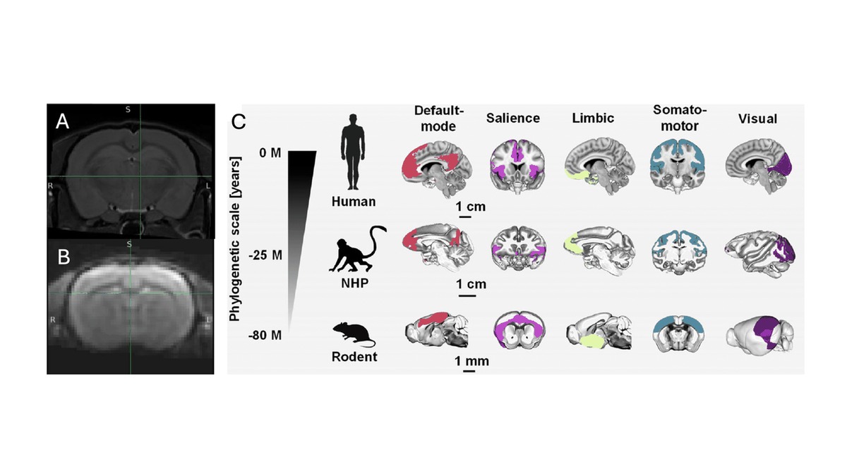 Rat and human brain networks drawn side by side, with conserved network hubs highlighted in both species.