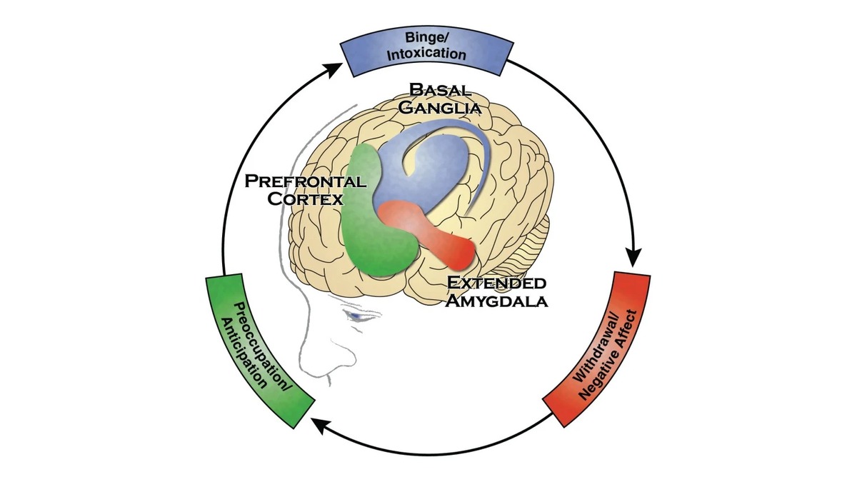 The three-stage addiction cycle drawn around a human brain: binge/intoxication (basal ganglia), withdrawal/negative affect (extended amygdala), and preoccupation/anticipation (prefrontal cortex).